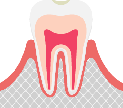 健全な歯
